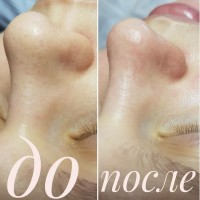 Косметологические процедуры